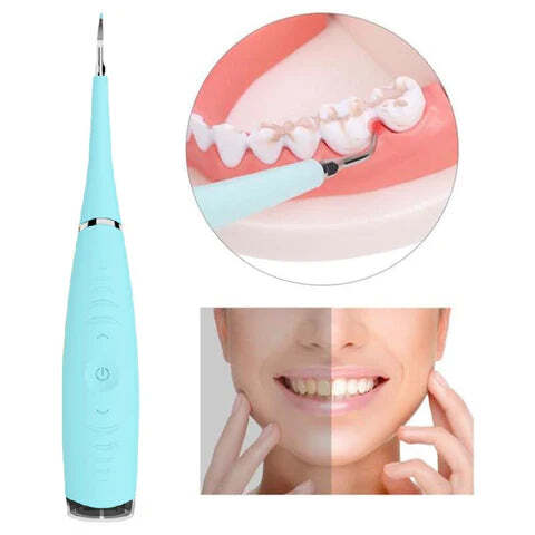 Removedor de Tártaro e Sujeiras - Dental - Imagem 4