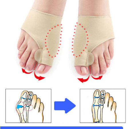 Meia Ortopédica FreeFeet© - Corretor de Joanete - Imagem 4