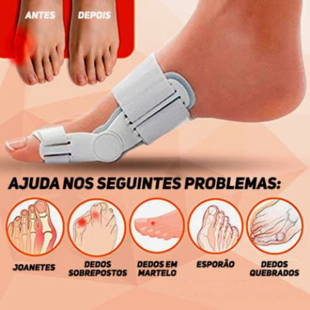 Corretor Ortopédico Articulado De Joanete - Imagem 4
