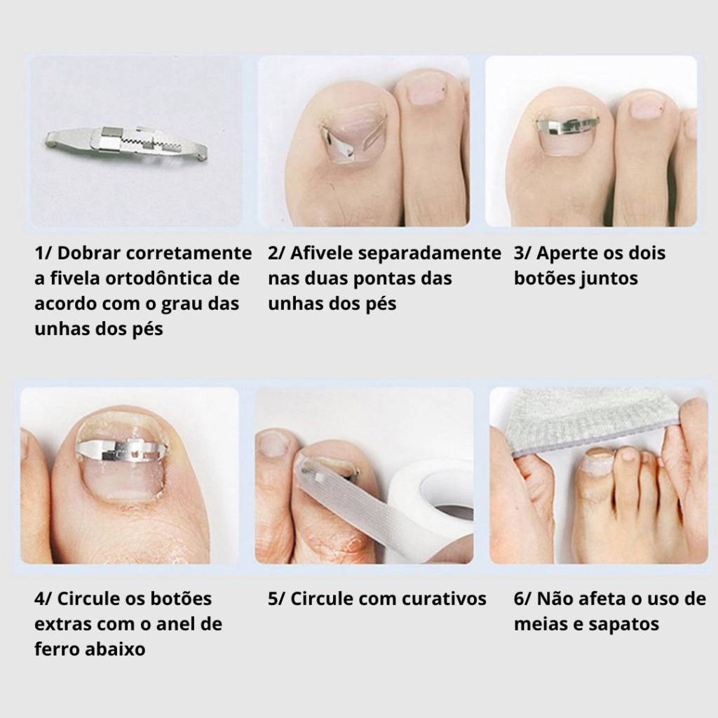 Kit Completo Para Desencravar Unhas | Clean Max + Brinde Exclusivo 🎁 - Imagem 4