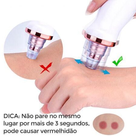 Removedor de Cravos e Espinhas PeleLow® - Imagem 7