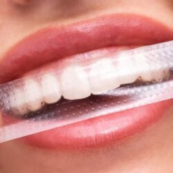PAP+ - Adesivo para Clareamento Dental
