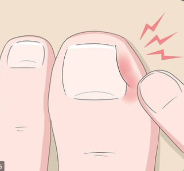 Alicate Para Desencravar Unhas | Clean Max - Imagem 6