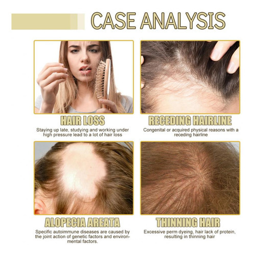 2 Unidades De Óleo Essencial, Cabelo De Alecrim, Pele Oleosa - Imagem 4