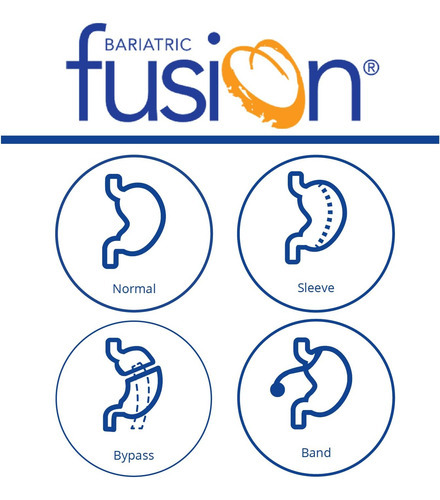 Multivitamínico Bariátrico Fusion Bariátrico Sem Ferro | Pac - Imagem 7