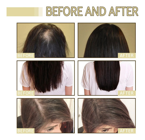 2 Unidades De Óleo Essencial, Cabelo De Alecrim, Pele Oleosa - Imagem 7