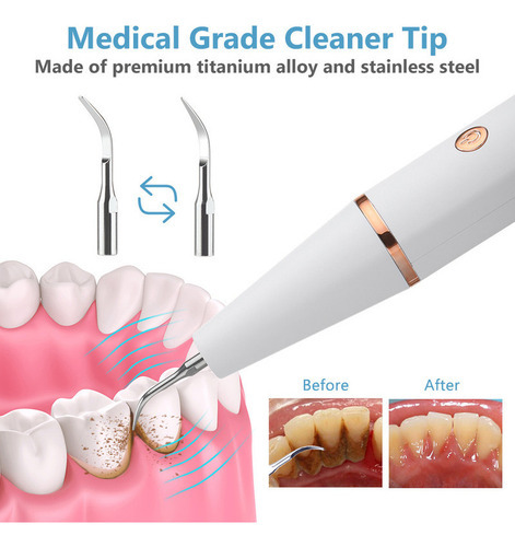 Aparelho Limpeza De Placa E Tártaro Remove Limpa Dentes - Imagem 7