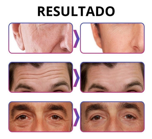 Creme Anti-rugas De Colágeno Masculino 50g - Imagem 5
