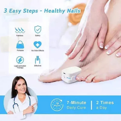 Para A Aparelho A Laser Elimina Fungos Micose Nas Unhas - Imagem 9
