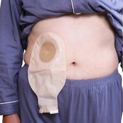 Sacos De Ostomia Bolsas Drenáveis De 30 Peças Para Colostomi - Imagem 4