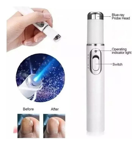 2 Peças De Caneta De Pincel De Unhas Color Light - Imagem 3