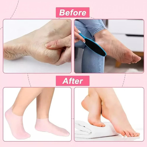 6 Meias Silicone Anti Crack E Hidratantes Para Pés Saudáveis - Imagem 3
