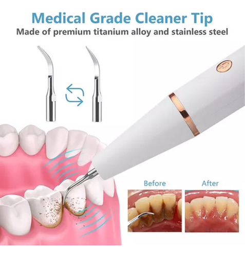 Máquina Ultrassônica De Limpeza De Cálculo E Tártaro - Imagem 6