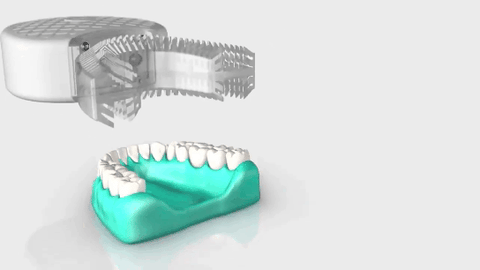 Nova Escova de Dentes Elétrica Sônica Automática Inteligente de 360 graus AZDENT