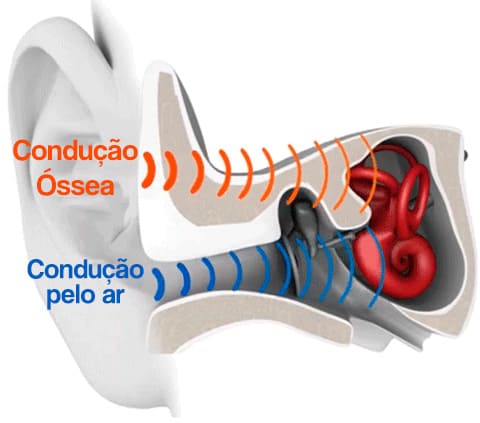 fone por condução óssea